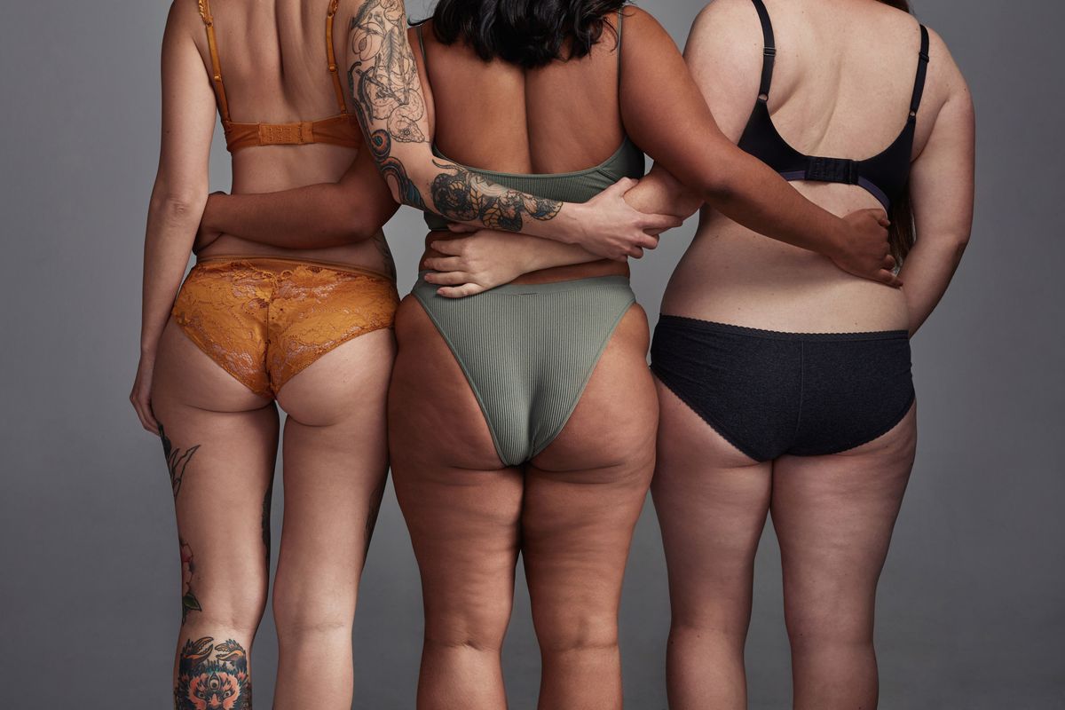 Orangenhaut Orangenhaut bei Damen von hinten
