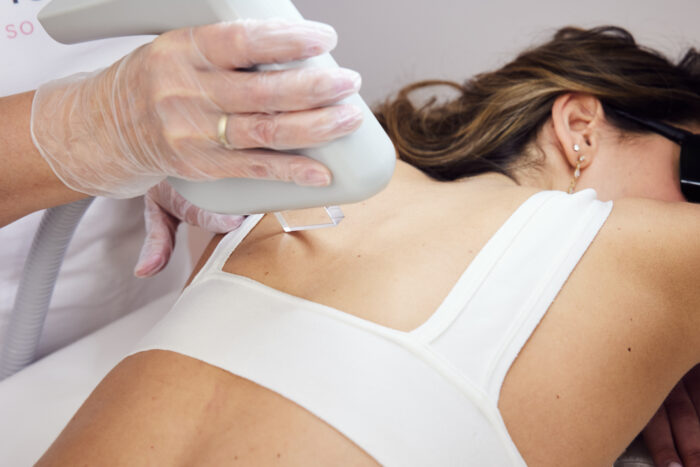 Behandlung Frauen Hairfree Behandlung Frau